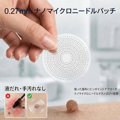 【✨本日最終日・80％OFF】2-in-1 マイクロニードル＆ハイドロコロイドパッチ｜盛り上がったほくろ・ニキビ・扁平イボ・スキンタッグを集中ケア｜シワ・傷跡・肌の気になる部分をなめらかに整える｜顔・ボディ用の目立ちにくい透明パッチ