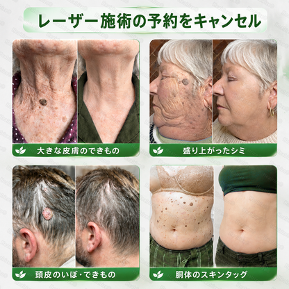 𝑯𝒆𝒂𝒍𝒓𝒊𝒛𝒆® 😽😽𝑷𝑫𝑹𝑵 エイジングケア＆気になるスポット集中ケアスティック（シワをなめらかに整え、ハリのある引き締まった印象の肌へ導き、気になるスポットの目立ちにくい肌をサポート）
