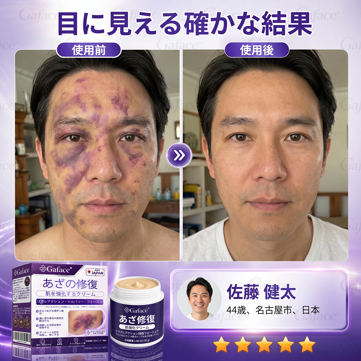 【累計販売11万個突破】💟🎃 Gaface® スキンバリア強化＆ダメージ肌ケアクリーム
